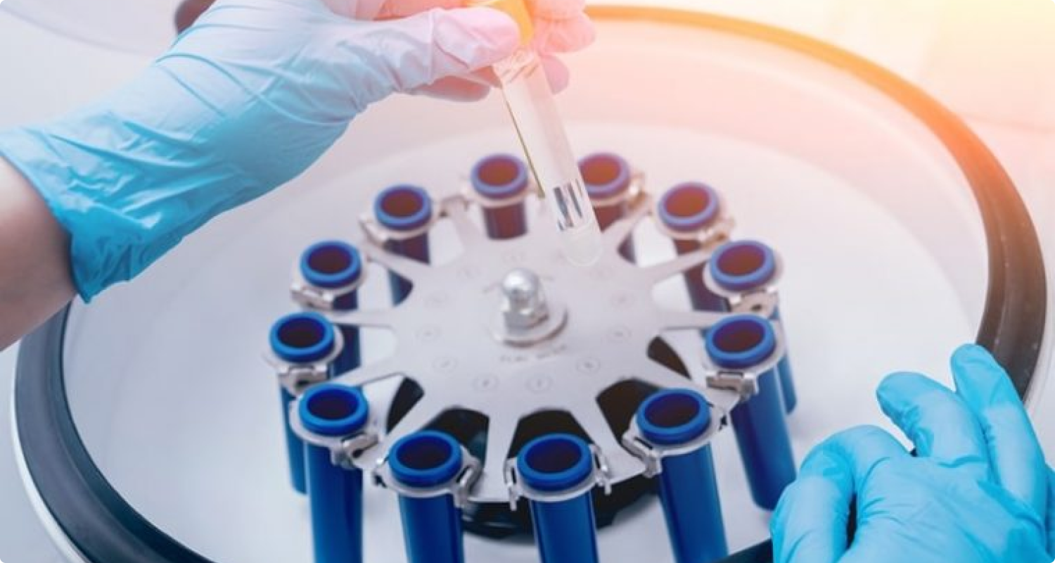 dentiste taverny ecrans buccaux Technologies Horizon Sourire | Chirurgiens-dentistes Beauchamp