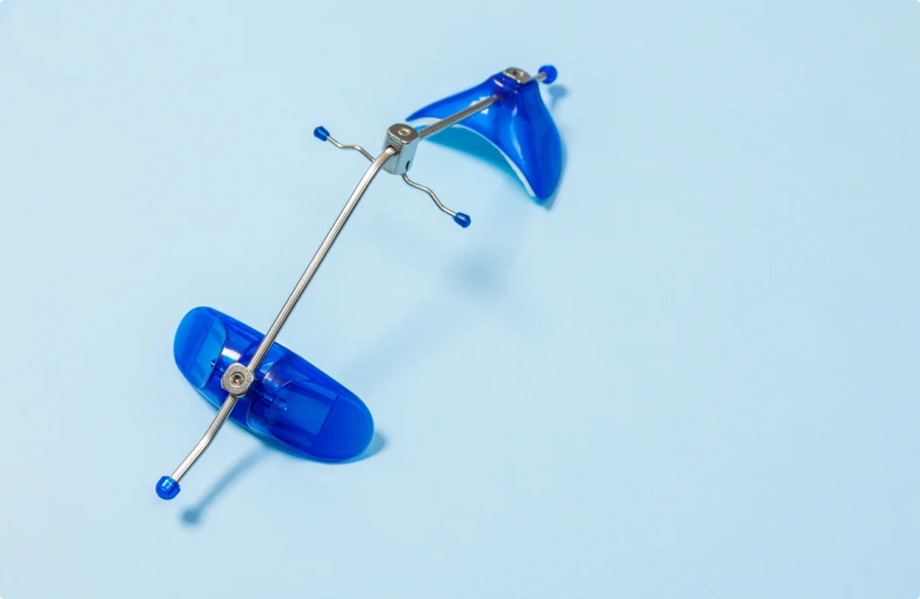 appareils orthodontiques adulte invisible appareils orthodontiques adulte invisible Appareils orthodontiques Horizon Sourire | Chirurgiens-dentistes Beauchamp