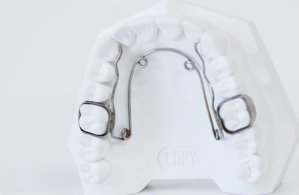 appareils orthodontiques bielle pul appareils orthodontiques bielle pul Appareils orthodontiques Horizon Sourire | Chirurgiens-dentistes Beauchamp