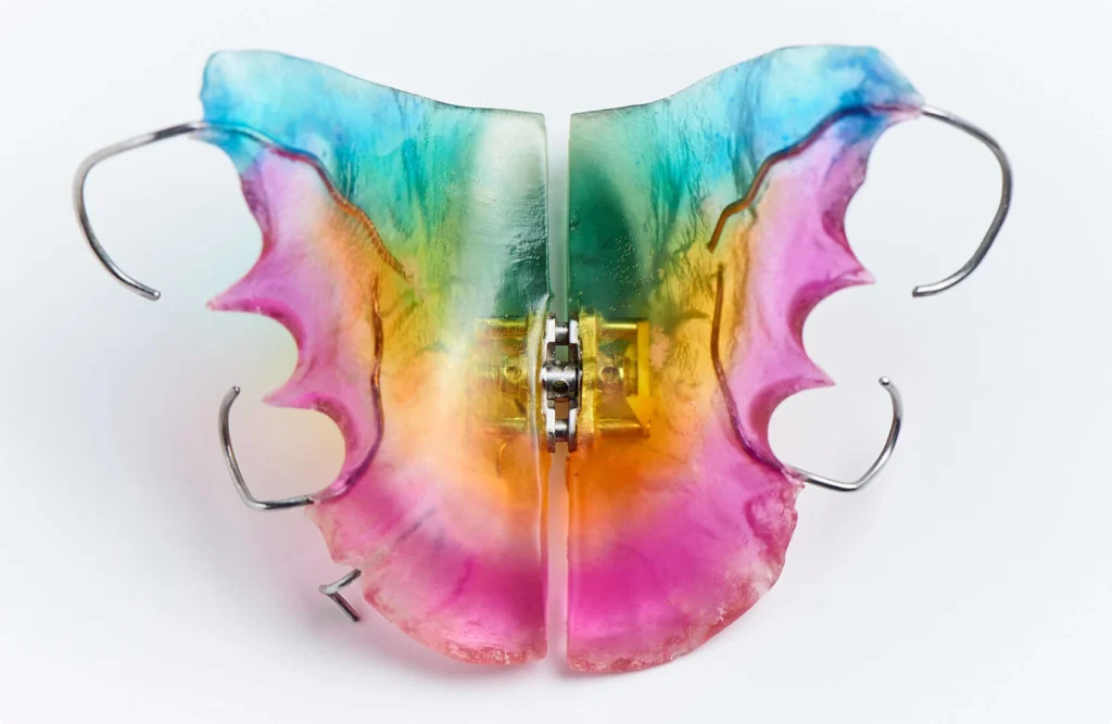 appareils orthodontiques plaque palatine appareils orthodontiques plaque palatine Appareils orthodontiques Horizon Sourire | Chirurgiens-dentistes Beauchamp